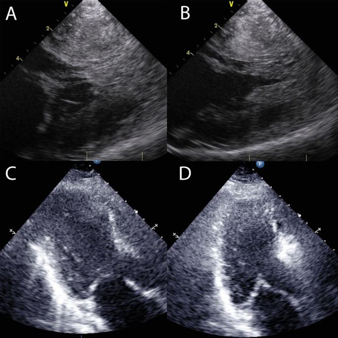https://cdn.ncbi.nlm.nih.gov/pmc/blobs/d886/4676484/abdd635edca7/echo-02-9-g002.jpg