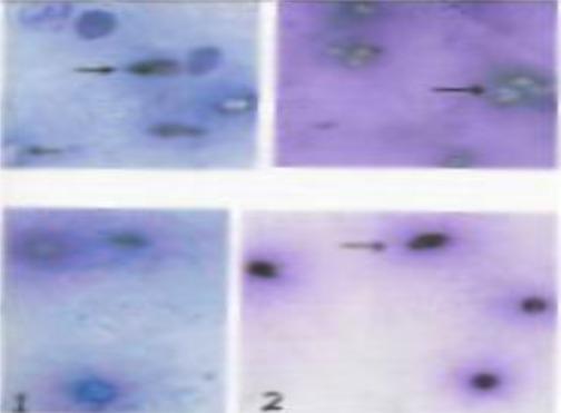 https://cdn.ncbi.nlm.nih.gov/pmc/blobs/d887/3371981/33755af3535b/ircmj-13-480-g002.jpg