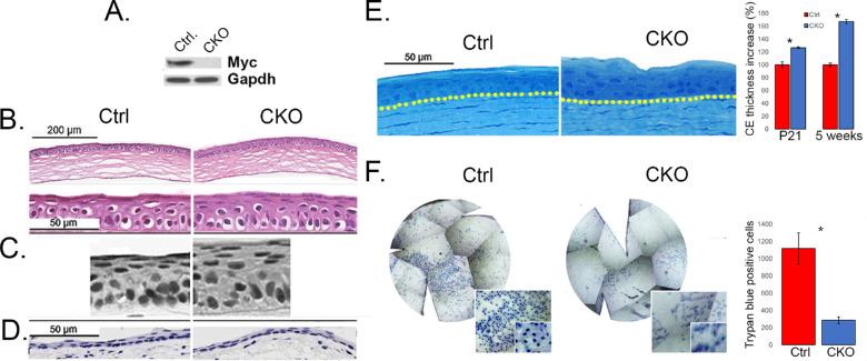 https://cdn.ncbi.nlm.nih.gov/pmc/blobs/d888/8822362/537ae08958b0/iovs-63-2-3-f002.jpg
