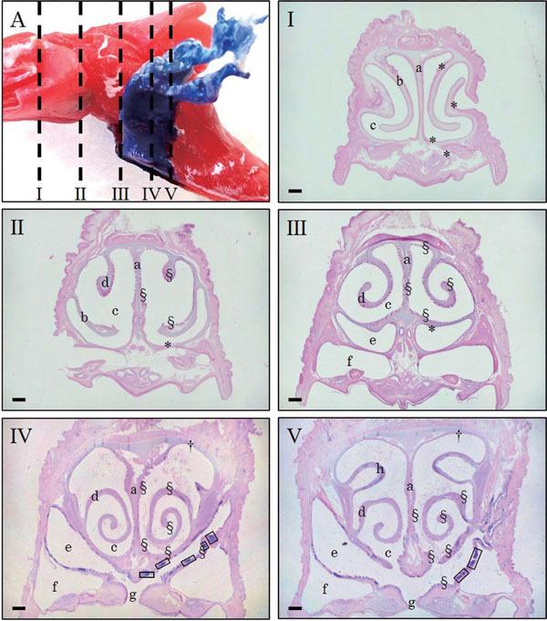 https://cdn.ncbi.nlm.nih.gov/pmc/blobs/d88f/7596029/731424f9d9e1/57_303_3.jpg