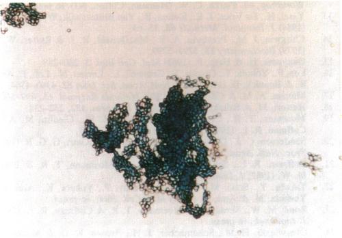 https://cdn.ncbi.nlm.nih.gov/pmc/blobs/d897/299301/3a5658ff37b2/pnas00336-0041-d.jpg
