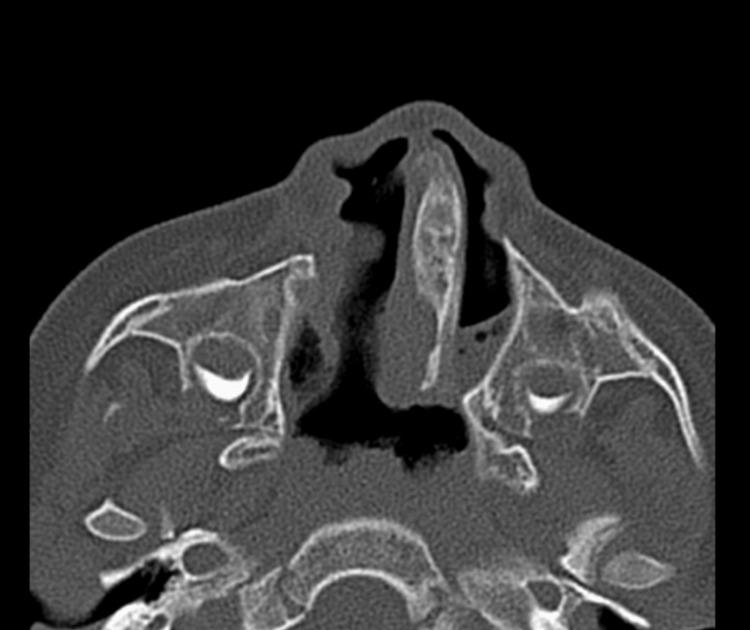 https://cdn.ncbi.nlm.nih.gov/pmc/blobs/d89d/9462955/2977abd114ba/cureus-0014-00000028928-i02.jpg