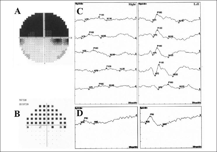 https://cdn.ncbi.nlm.nih.gov/pmc/blobs/d89f/2993985/1b0a3087d87b/IJO-58-524-g004.jpg