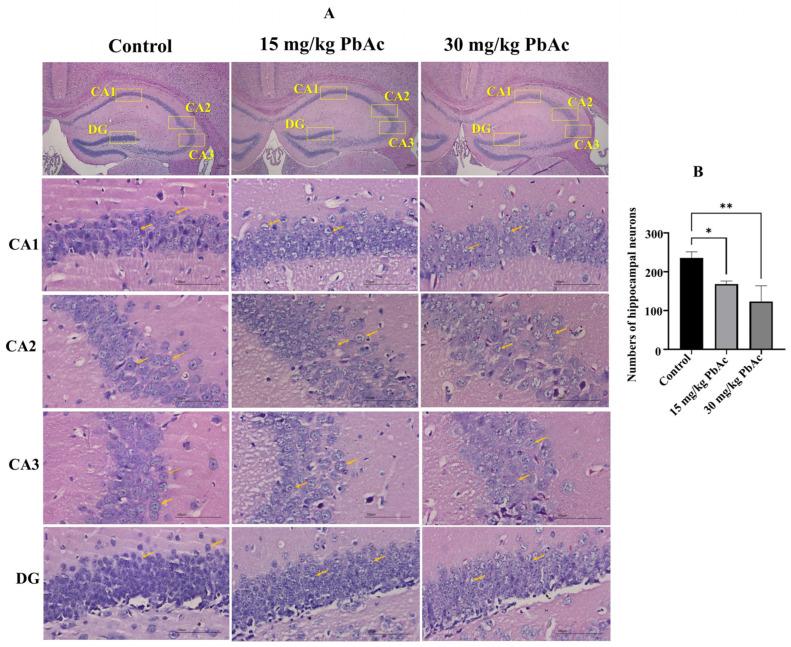 https://cdn.ncbi.nlm.nih.gov/pmc/blobs/d8a0/12197489/1da7c2035a78/toxics-13-00465-g005.jpg