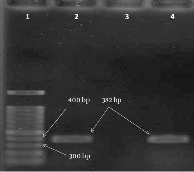 https://cdn.ncbi.nlm.nih.gov/pmc/blobs/d8a4/4584137/d4809c325c31/jjm-08-07-20980-g001.jpg