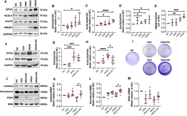https://cdn.ncbi.nlm.nih.gov/pmc/blobs/d8a6/11239900/dbf9a0c04fd7/41420_2024_2071_Fig7_HTML.jpg