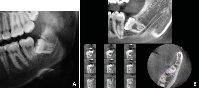 https://cdn.ncbi.nlm.nih.gov/pmc/blobs/d8ab/3691370/1b71889f901d/isd-43-105-g001.jpg