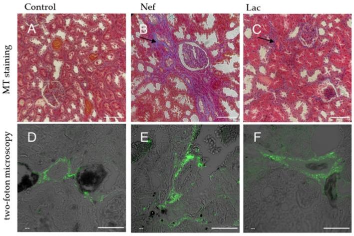 https://cdn.ncbi.nlm.nih.gov/pmc/blobs/d8af/7999732/172347e30415/toxins-13-00192-g004.jpg