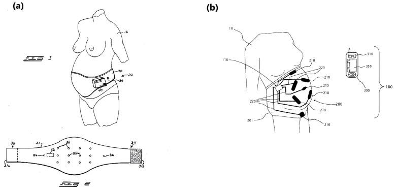 https://cdn.ncbi.nlm.nih.gov/pmc/blobs/d8b4/11436206/4a377527e3d7/sensors-24-06066-g007.jpg