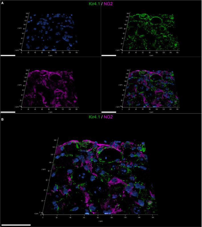 https://cdn.ncbi.nlm.nih.gov/pmc/blobs/d8b6/8278083/8395fd9518ba/JCMM-25-6909-g002.jpg