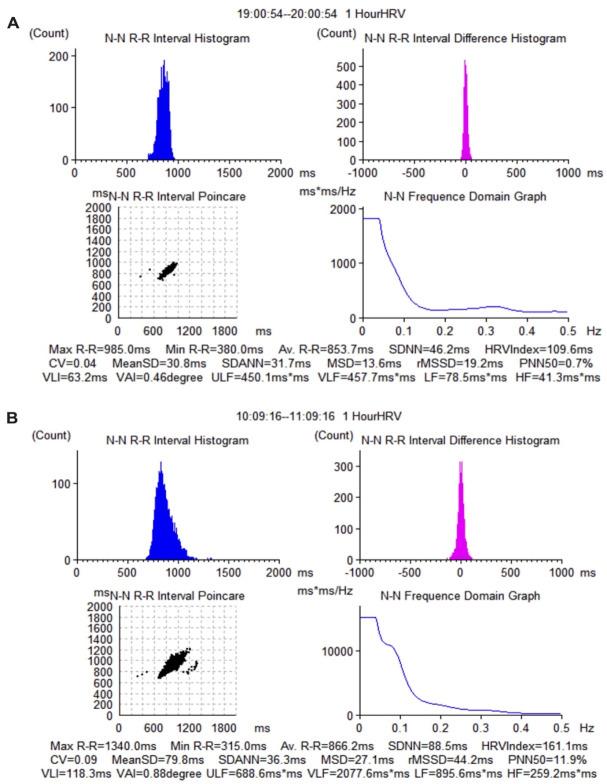 https://cdn.ncbi.nlm.nih.gov/pmc/blobs/d8bc/10541060/62ea597fea36/CHSJ-49-02-172-fig2.jpg