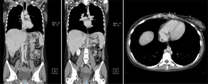 https://cdn.ncbi.nlm.nih.gov/pmc/blobs/d8be/11716300/693a31212c7f/5015_Fig1.jpg