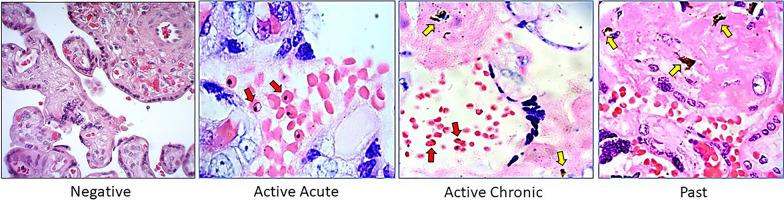 https://cdn.ncbi.nlm.nih.gov/pmc/blobs/d8c8/11064279/116dd06d965f/12936_2024_4960_Fig5_HTML.jpg