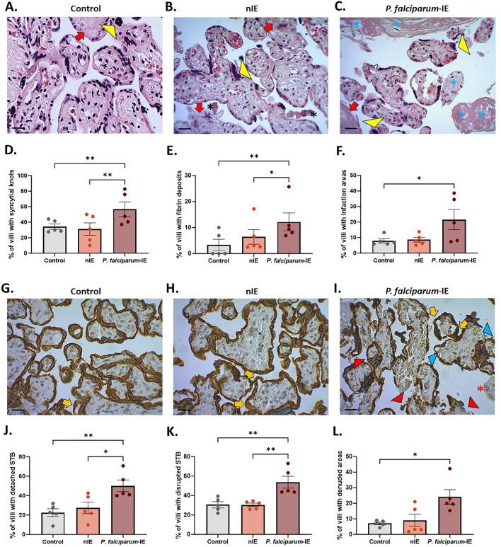 https://cdn.ncbi.nlm.nih.gov/pmc/blobs/d8c8/11064279/7586734c2d04/12936_2024_4960_Fig2_HTML.jpg