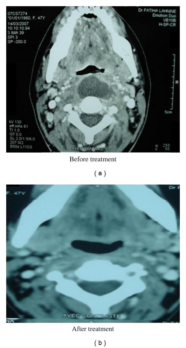 https://cdn.ncbi.nlm.nih.gov/pmc/blobs/d8db/3201680/aa141d62e994/TSWJ11-915163.006.jpg