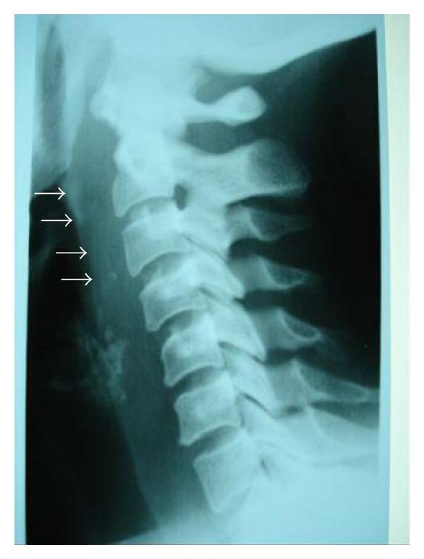 https://cdn.ncbi.nlm.nih.gov/pmc/blobs/d8db/3201680/c66ade4032f9/TSWJ11-915163.002.jpg