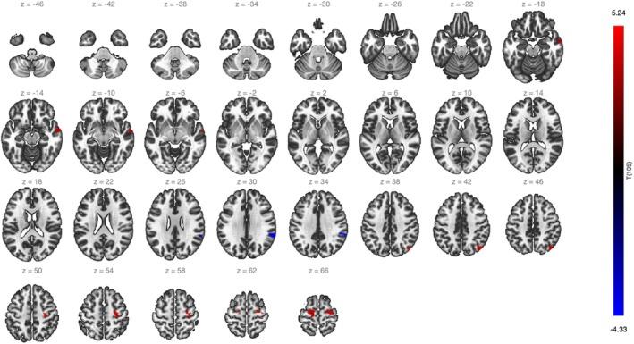 https://cdn.ncbi.nlm.nih.gov/pmc/blobs/d8dd/12174507/34788b92c3c0/ACER-49-1221-g004.jpg