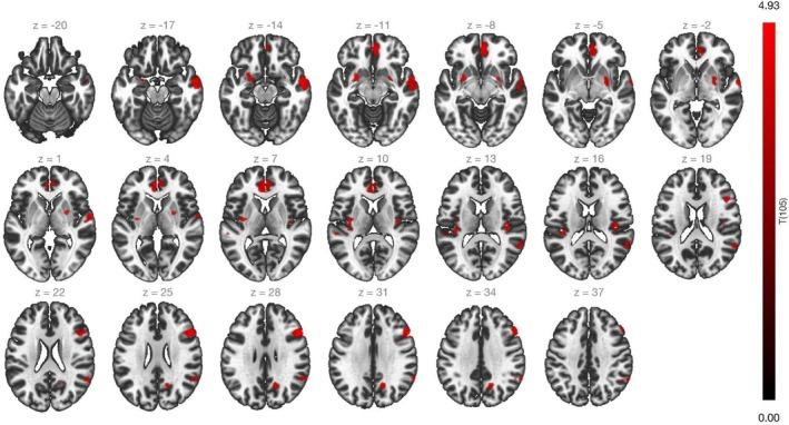https://cdn.ncbi.nlm.nih.gov/pmc/blobs/d8dd/12174507/af3833a0e20c/ACER-49-1221-g003.jpg