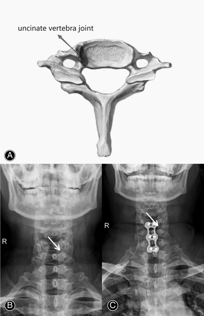 https://cdn.ncbi.nlm.nih.gov/pmc/blobs/d8e2/10102297/b390ab081aab/OS-15-1085-g006.jpg