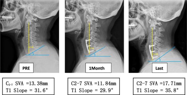 https://cdn.ncbi.nlm.nih.gov/pmc/blobs/d8e2/10102297/cd86976866c5/OS-15-1085-g007.jpg