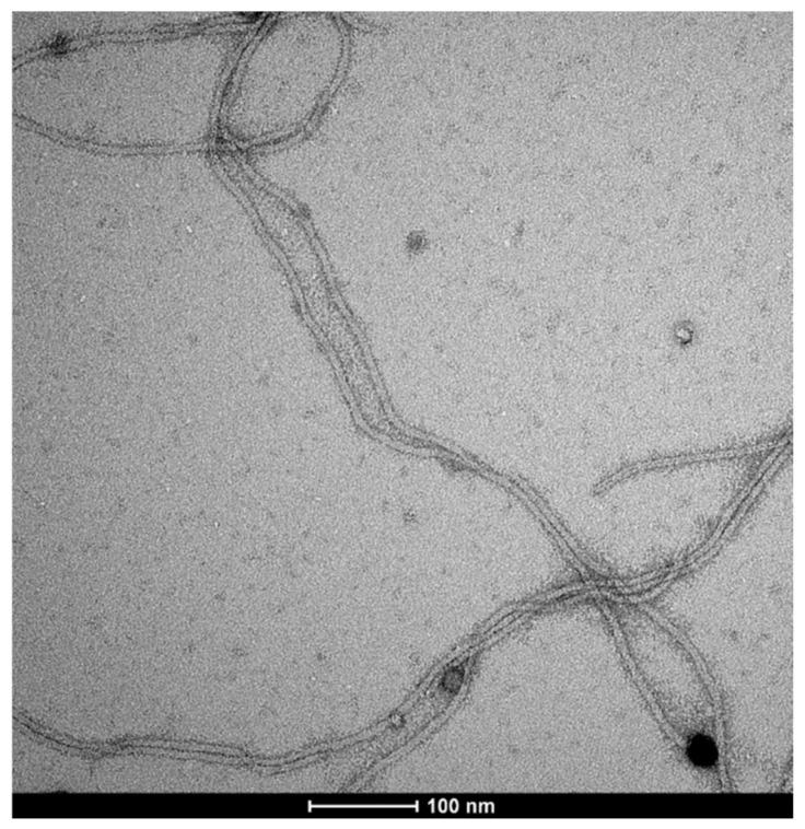 https://cdn.ncbi.nlm.nih.gov/pmc/blobs/d8e8/11508339/155dd21739d4/ijms-25-11222-g010.jpg