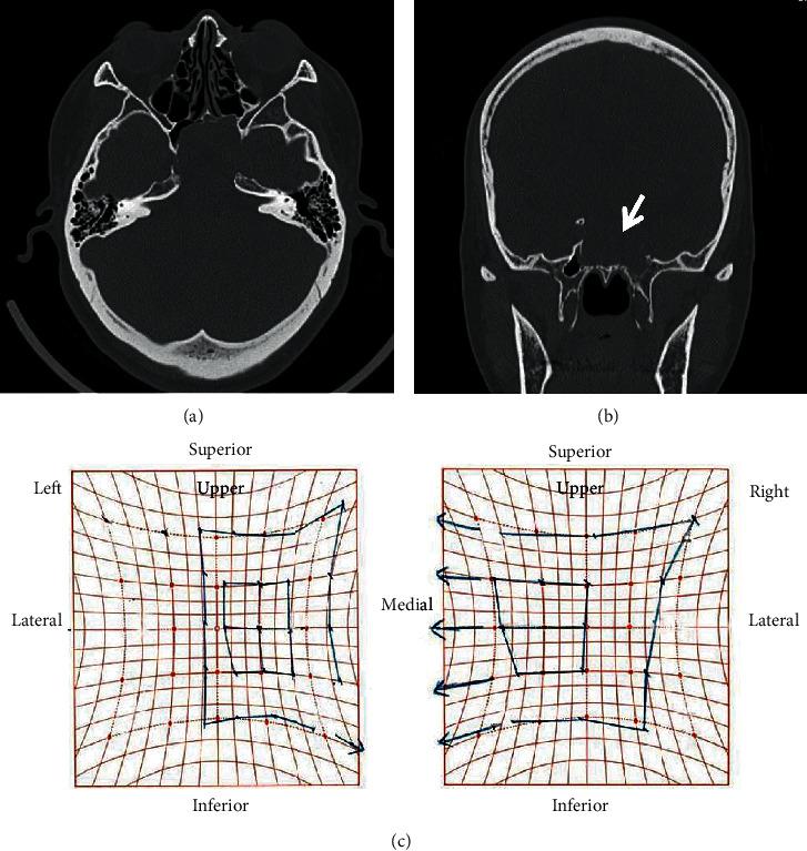 https://cdn.ncbi.nlm.nih.gov/pmc/blobs/d8e9/7686843/506e31be943e/CRIOT2020-8897868.003.jpg