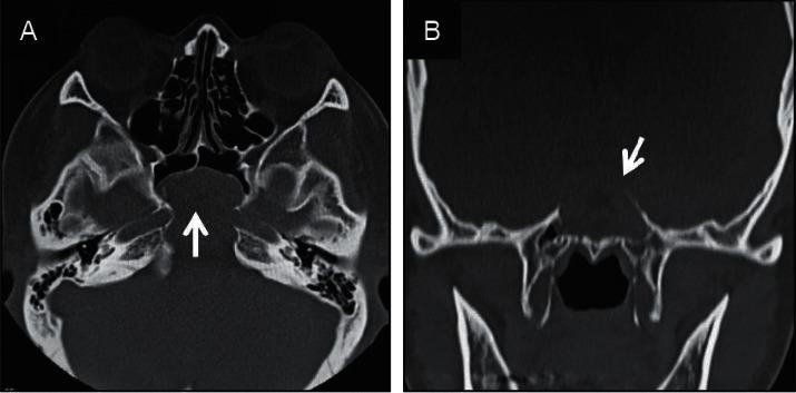 https://cdn.ncbi.nlm.nih.gov/pmc/blobs/d8e9/7686843/a21737f28897/CRIOT2020-8897868.001.jpg
