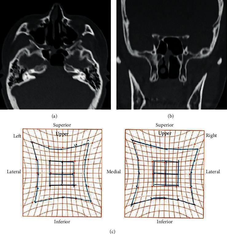 https://cdn.ncbi.nlm.nih.gov/pmc/blobs/d8e9/7686843/d45572bfe8ae/CRIOT2020-8897868.006.jpg