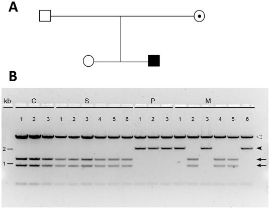 https://cdn.ncbi.nlm.nih.gov/pmc/blobs/d8ed/3222643/6317fec7075f/pone.0027348.g003.jpg