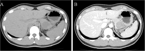 https://cdn.ncbi.nlm.nih.gov/pmc/blobs/d8ed/4090630/0476cadf1c30/1752-1947-8-243-1.jpg