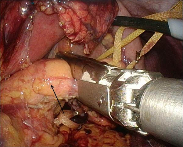 https://cdn.ncbi.nlm.nih.gov/pmc/blobs/d8ed/4090630/1f73ecd4ae1a/1752-1947-8-243-5.jpg