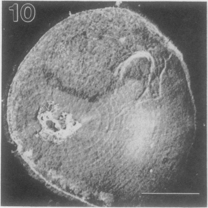 https://cdn.ncbi.nlm.nih.gov/pmc/blobs/d8f6/1077489/c209e5ce7812/plntphys00814-0106-g.jpg