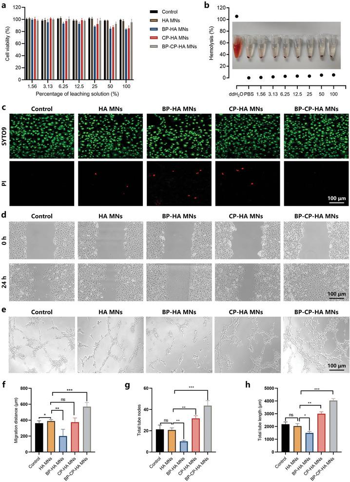 https://cdn.ncbi.nlm.nih.gov/pmc/blobs/d8f7/11884594/c1ae02cadf35/ADVS-12-2412226-g009.jpg