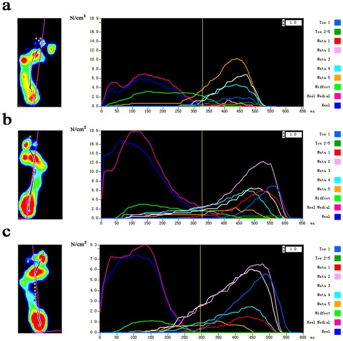 https://cdn.ncbi.nlm.nih.gov/pmc/blobs/d8f8/5908870/5b9fd9f8f704/41598_2018_24737_Fig3_HTML.jpg