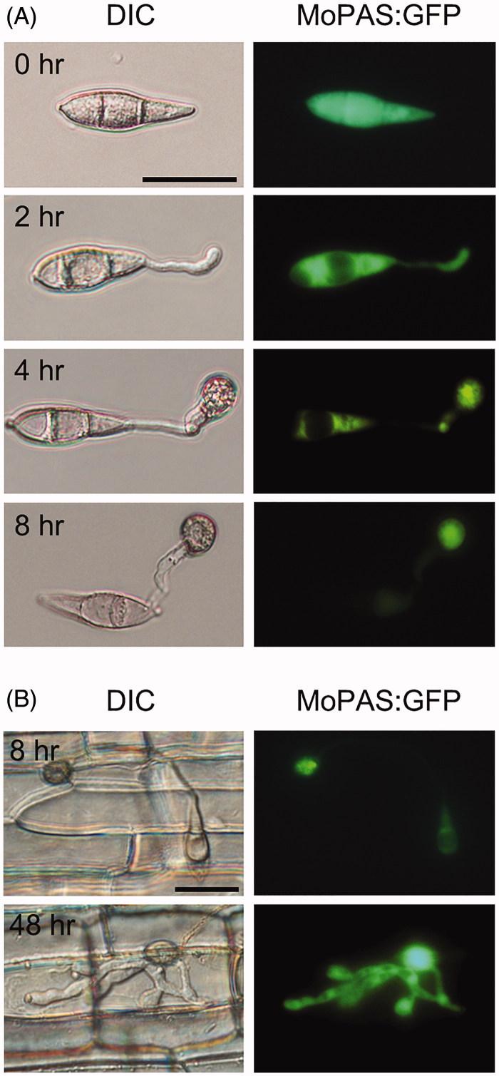 https://cdn.ncbi.nlm.nih.gov/pmc/blobs/d8fb/6968698/3cd09e1a0fac/TMYB_A_1689037_F0007_C.jpg