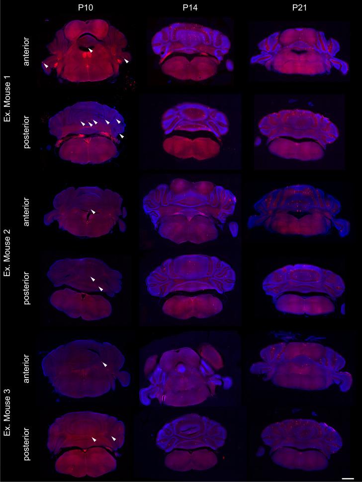 https://cdn.ncbi.nlm.nih.gov/pmc/blobs/d8fe/8195607/a2bd68aa4585/elife-63668-fig5-figsupp1.jpg