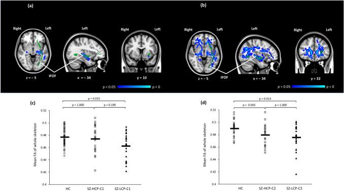 https://cdn.ncbi.nlm.nih.gov/pmc/blobs/d90d/9388472/e90945054f3a/406_2021_1363_Fig1_HTML.jpg