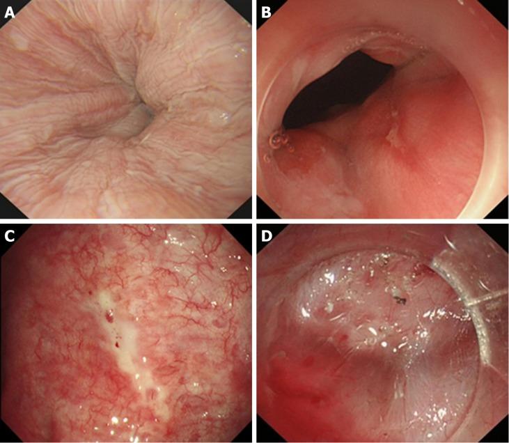 https://cdn.ncbi.nlm.nih.gov/pmc/blobs/d912/6385014/161c4a250bae/WJG-25-744-g008.jpg