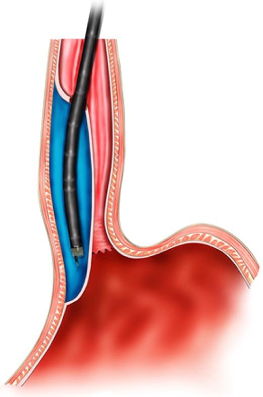https://cdn.ncbi.nlm.nih.gov/pmc/blobs/d912/6385014/1dd6037fb673/WJG-25-744-g001.jpg