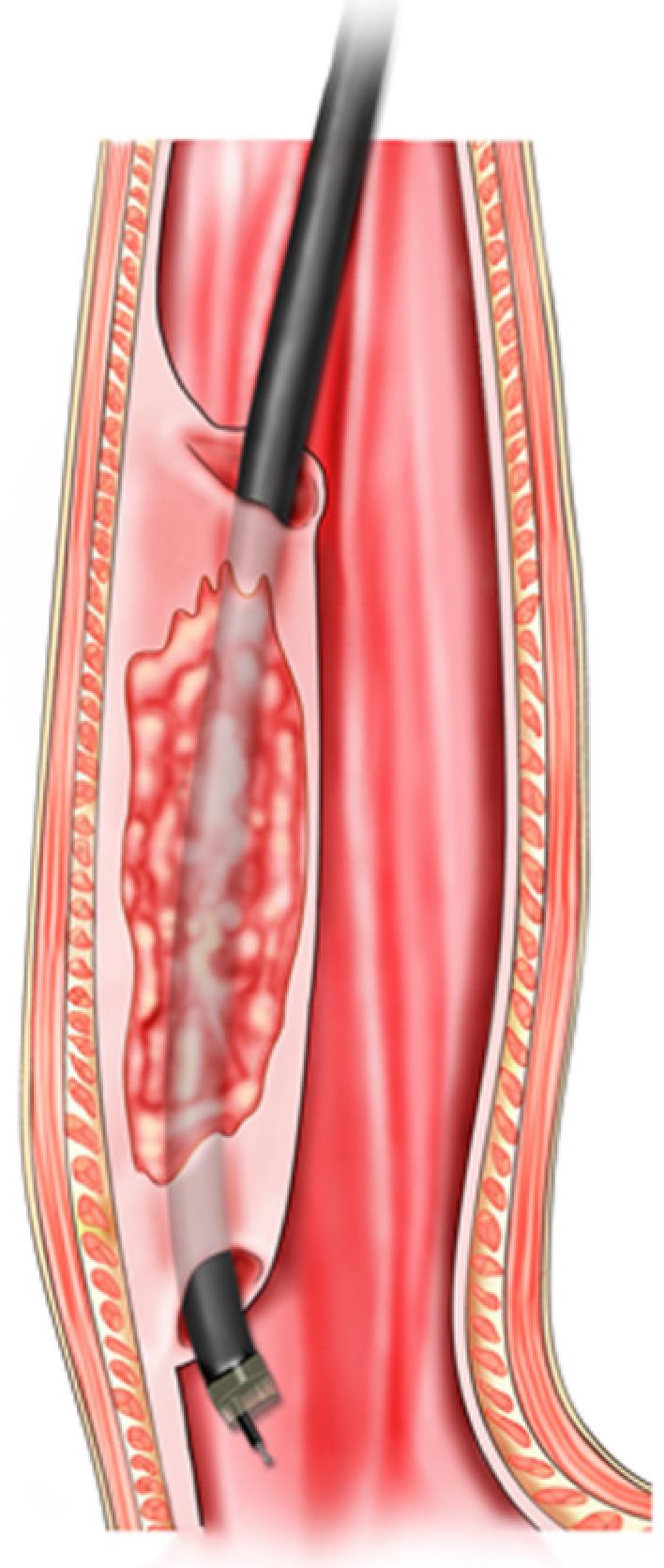 https://cdn.ncbi.nlm.nih.gov/pmc/blobs/d912/6385014/2ef6b4d31431/WJG-25-744-g003.jpg