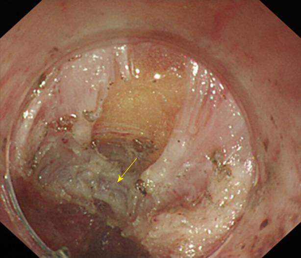 https://cdn.ncbi.nlm.nih.gov/pmc/blobs/d912/6385014/3b81d533aa0e/WJG-25-744-g014.jpg