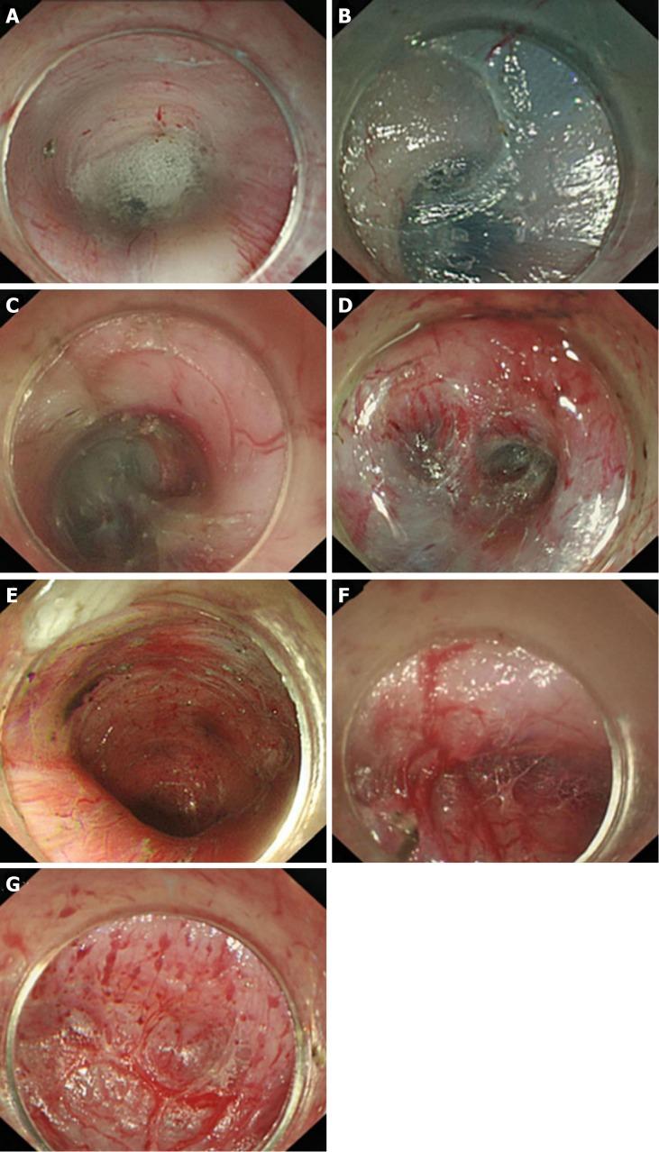 https://cdn.ncbi.nlm.nih.gov/pmc/blobs/d912/6385014/4e3daa6041c0/WJG-25-744-g009.jpg