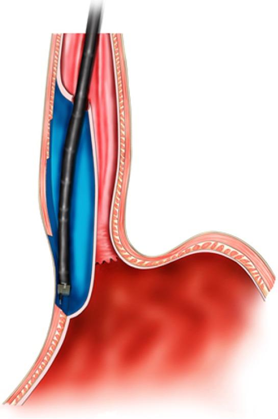 https://cdn.ncbi.nlm.nih.gov/pmc/blobs/d912/6385014/5aa722bc2239/WJG-25-744-g010.jpg
