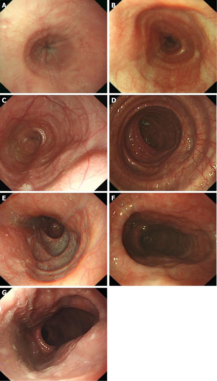 https://cdn.ncbi.nlm.nih.gov/pmc/blobs/d912/6385014/8e2d572a495f/WJG-25-744-g005.jpg