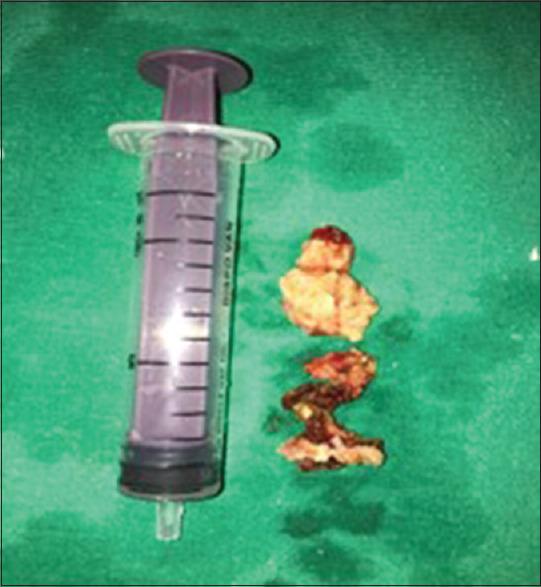 https://cdn.ncbi.nlm.nih.gov/pmc/blobs/d918/8386264/eb0522161436/NJMS-12-284-g005.jpg