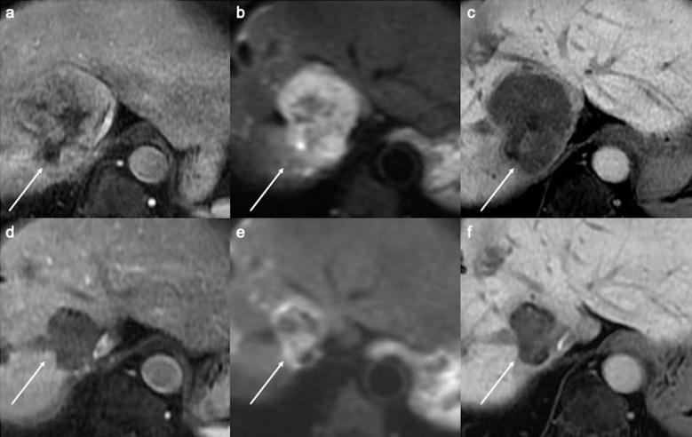 https://cdn.ncbi.nlm.nih.gov/pmc/blobs/d919/10086401/4817d8430390/mrms-22-209-g5.jpg