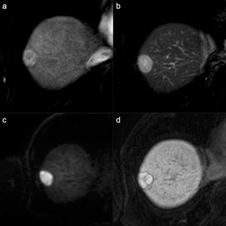 https://cdn.ncbi.nlm.nih.gov/pmc/blobs/d919/10086401/551355b861e3/mrms-22-209-g6.jpg