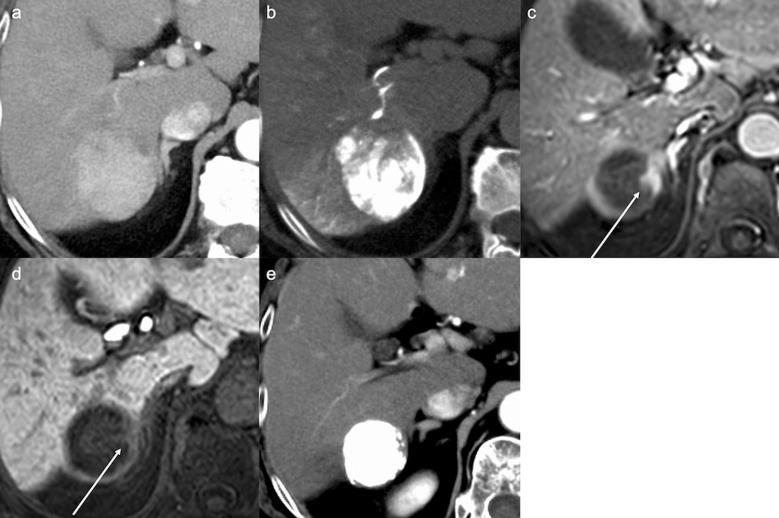 https://cdn.ncbi.nlm.nih.gov/pmc/blobs/d919/10086401/5f55db380861/mrms-22-209-g3.jpg
