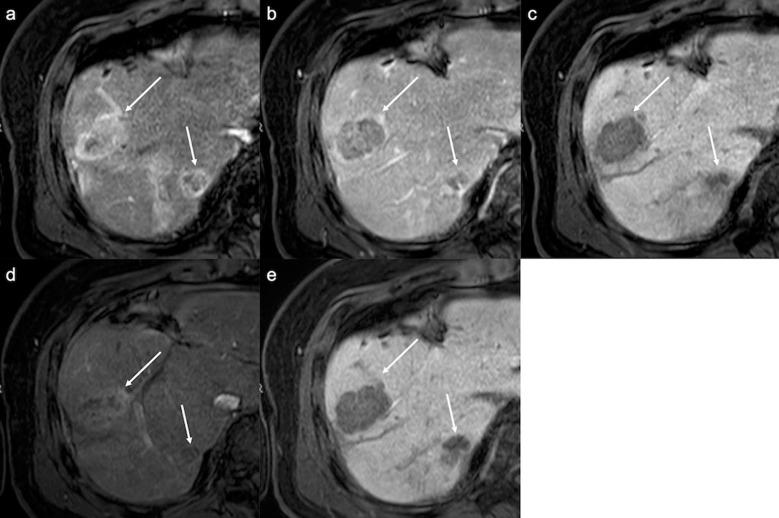 https://cdn.ncbi.nlm.nih.gov/pmc/blobs/d919/10086401/c01f14441a8f/mrms-22-209-g4.jpg