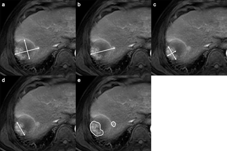https://cdn.ncbi.nlm.nih.gov/pmc/blobs/d919/10086401/c6eb1cb4c141/mrms-22-209-g1.jpg